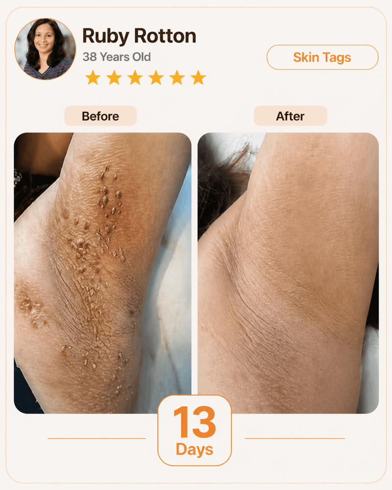 AGING HANDS & BODY